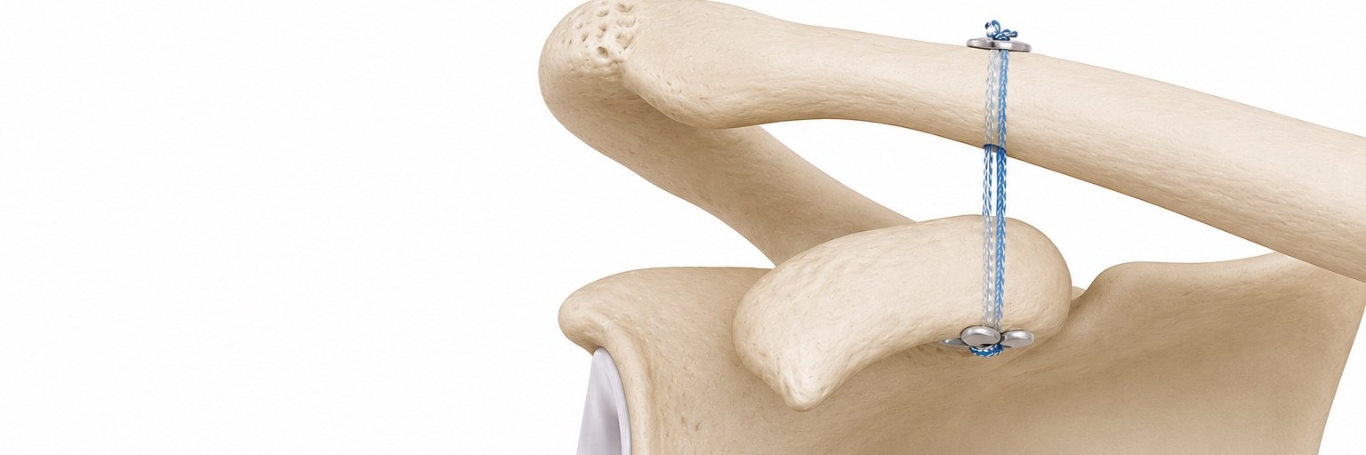 AC Joint Reconstruction