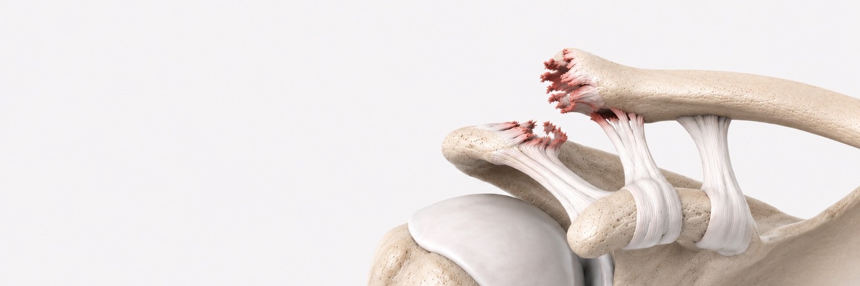 AC Joint Injuries