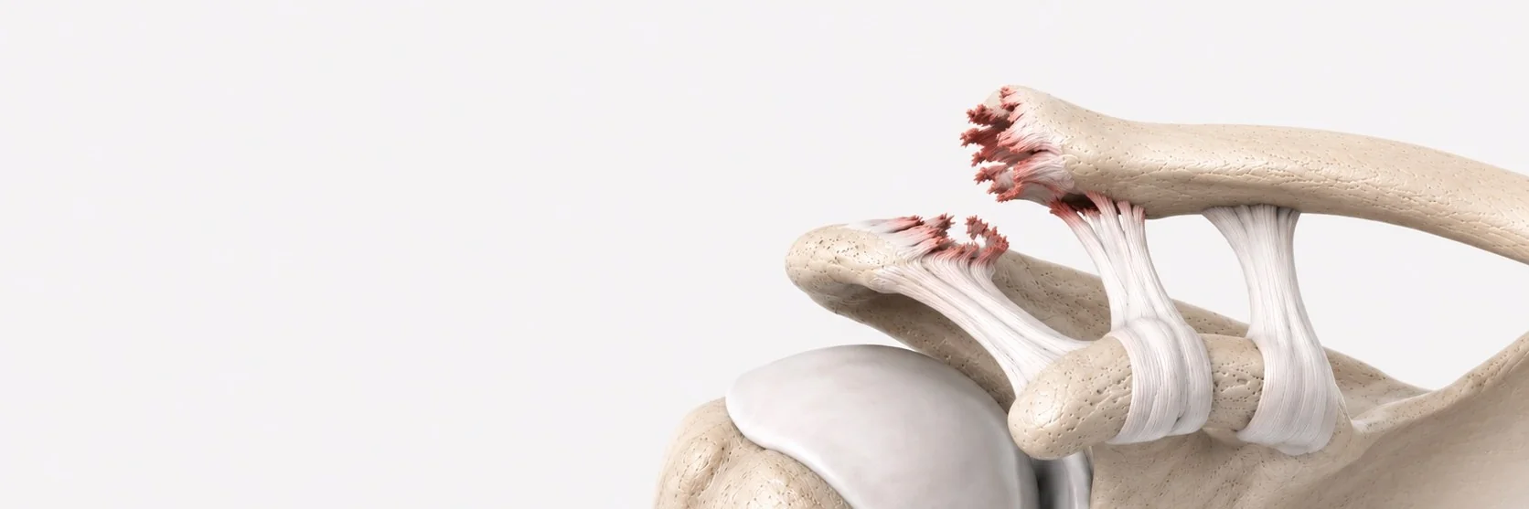AC Joint Injuries
