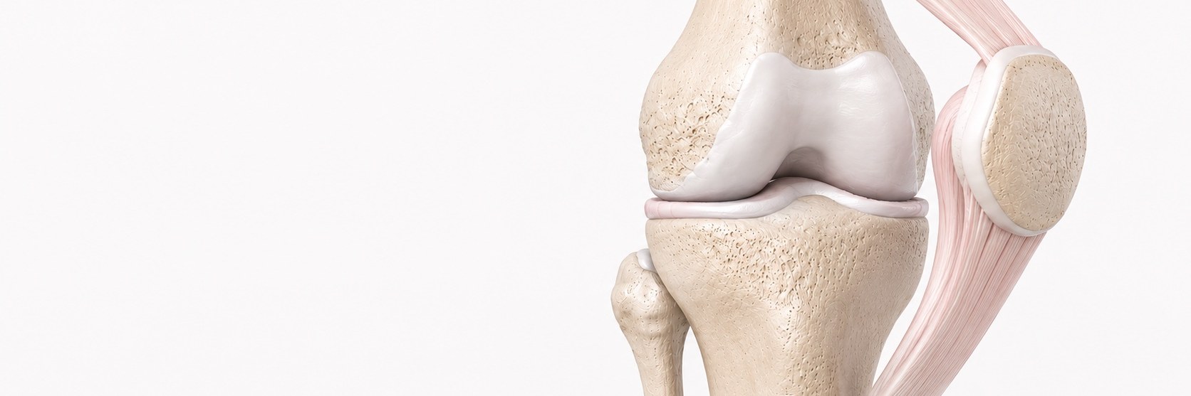 Patellar Instability