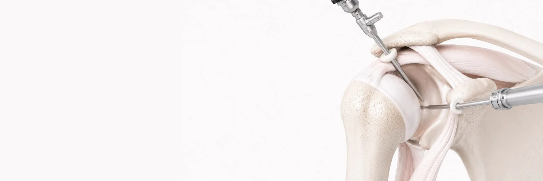 Shoulder Arthroscopy