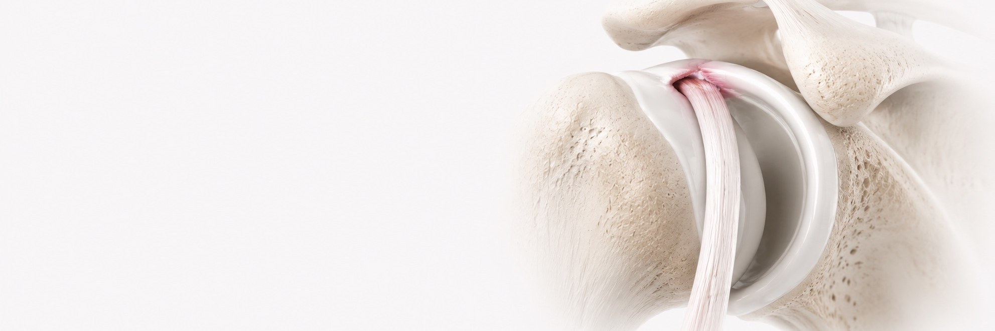 SLAP & Biceps Lesions